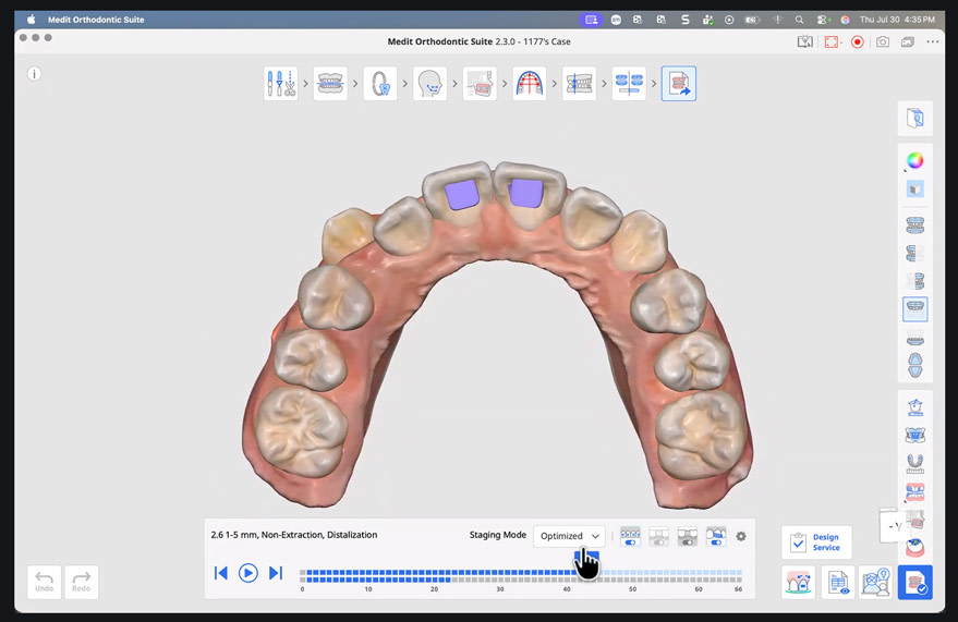 medit-ortho-suite-17
