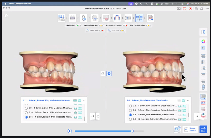medit-ortho-suite-21
