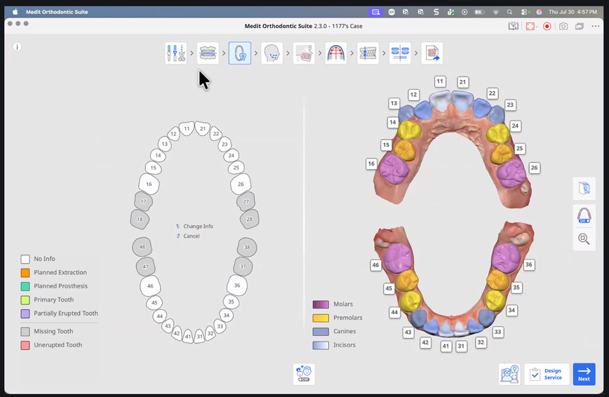 medit-ortho-suite-22