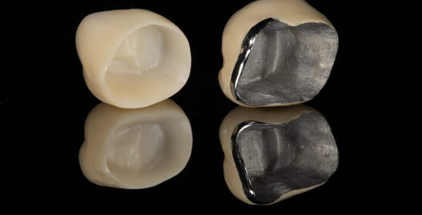 zirconia_vs_pfm
