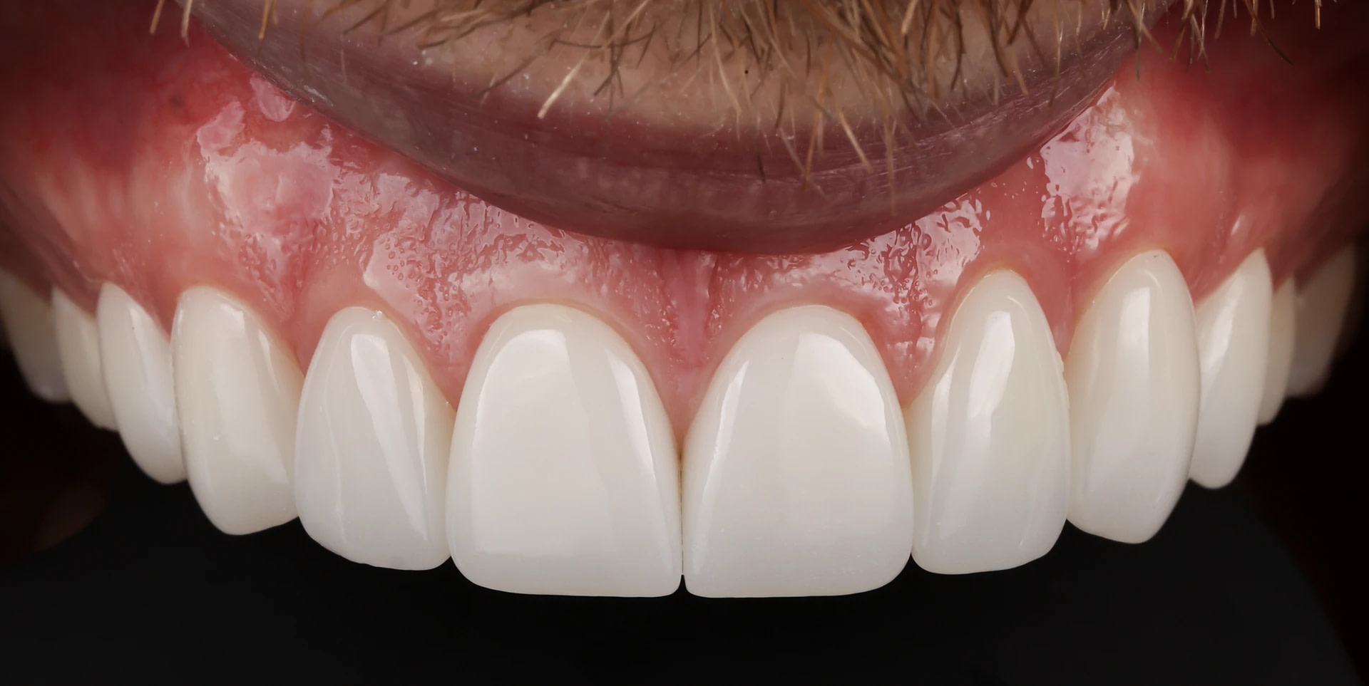digital-smile-design