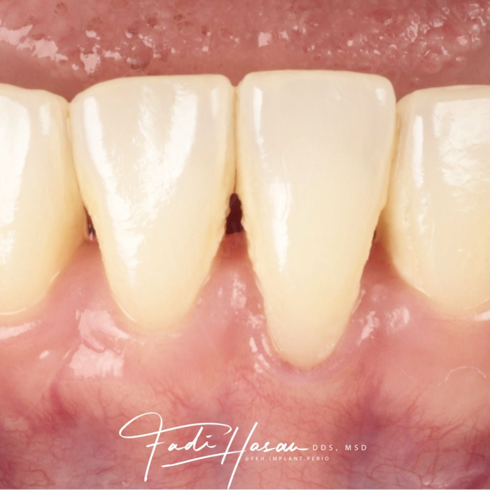 fadi-hasan-soft-tissue-02 fadi-hasan-soft-tissue