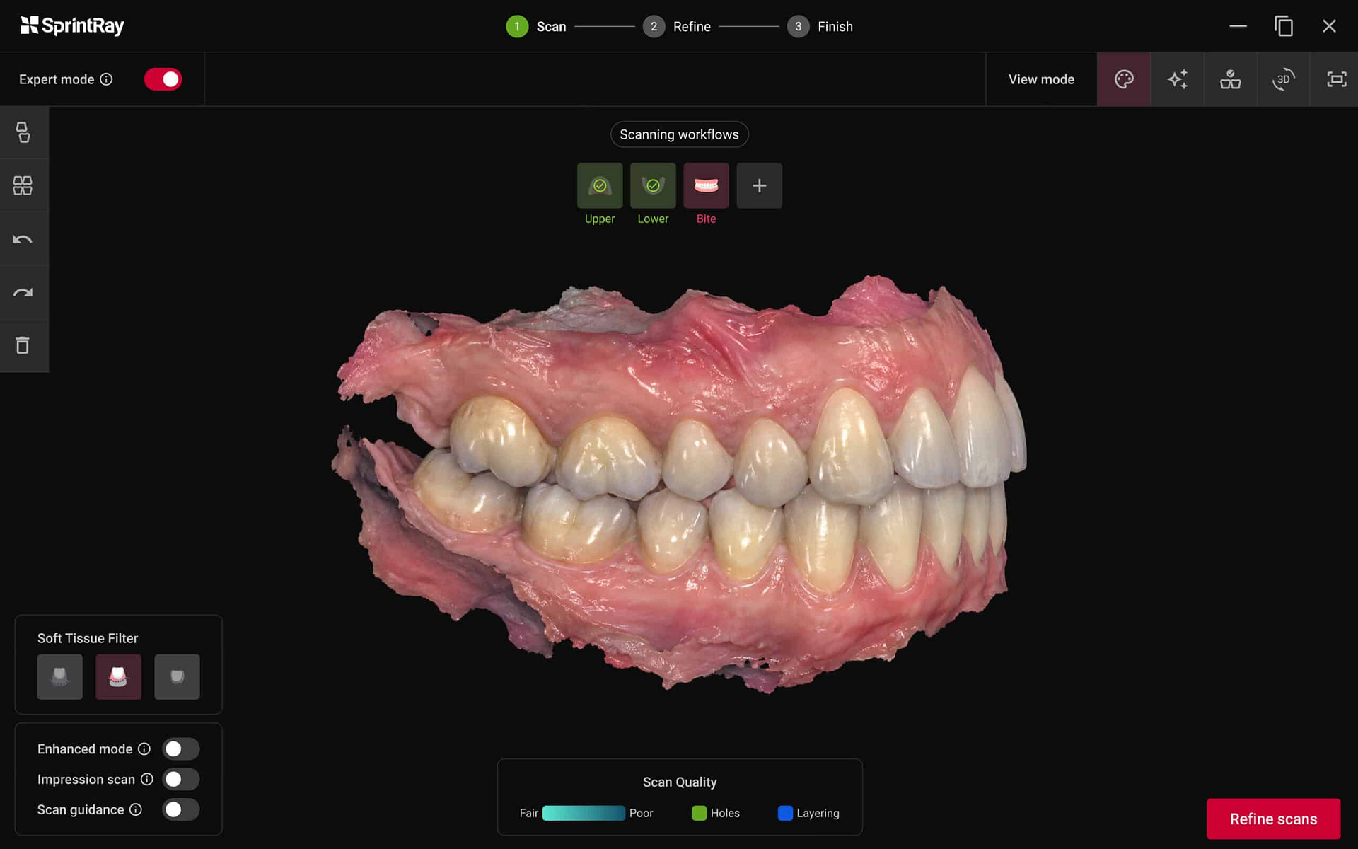 SprintRay-Foundation-scanner-intraoral-scanning-software-bite-scaled
